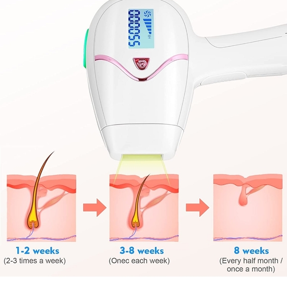 LASER HAIR REMOVER - Picture 2 of 3
